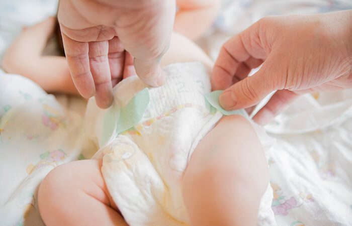 Diaper Rash 101 Six Ways to Help Prevent Diaper Rash