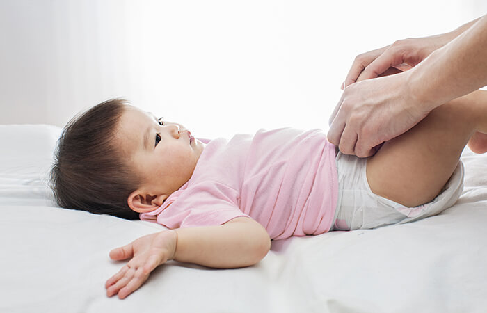 How to Heal Your Baby's Diaper Rash